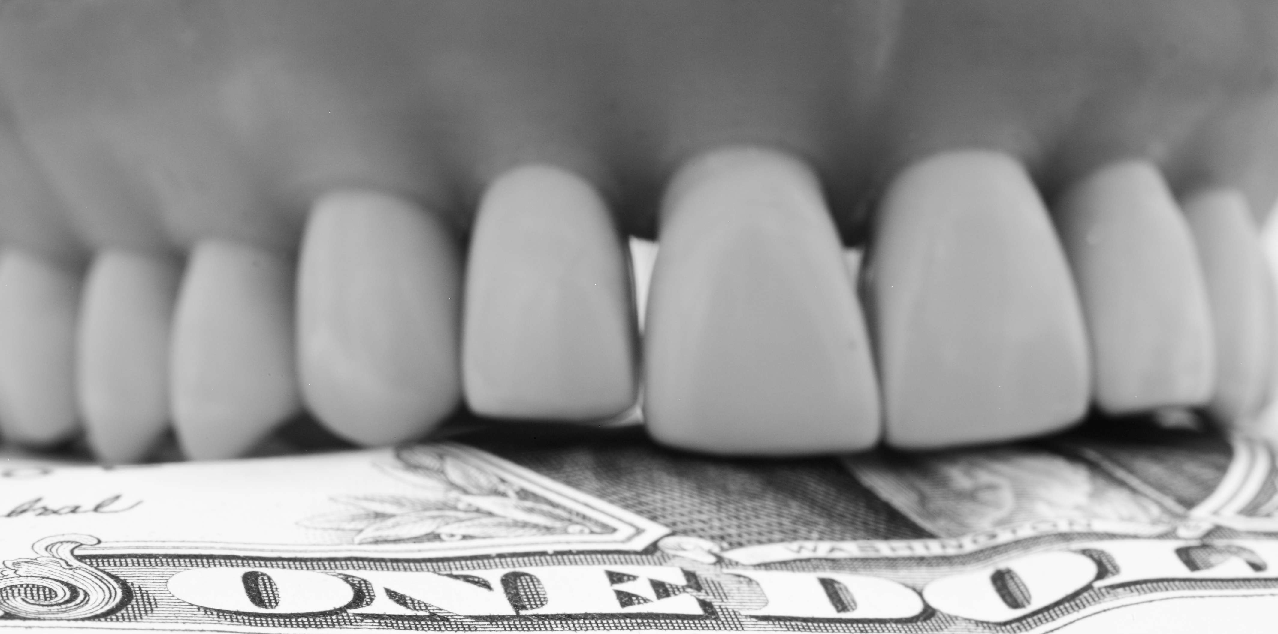 Bruxism dentist budget